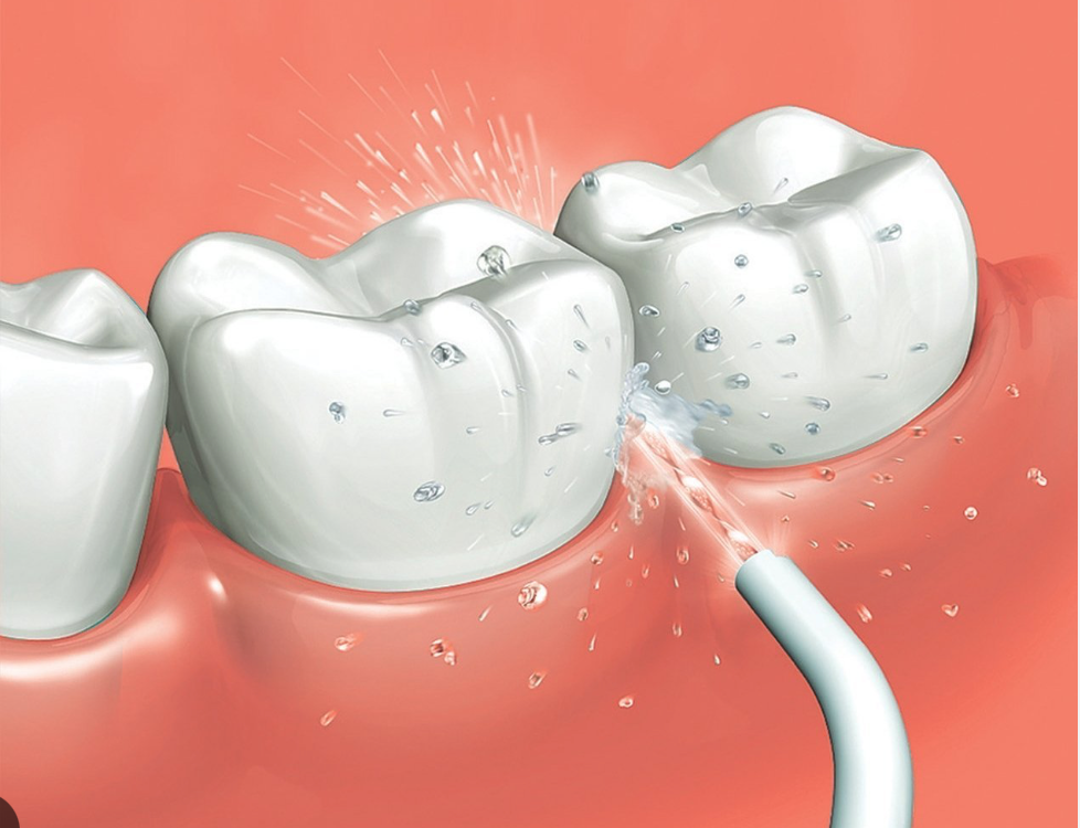 IRRIGADOR DENTAL